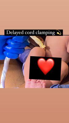 Delayed cord clamping