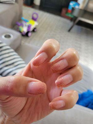 Gel nail.