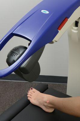 MLS Laser treatment for the foot