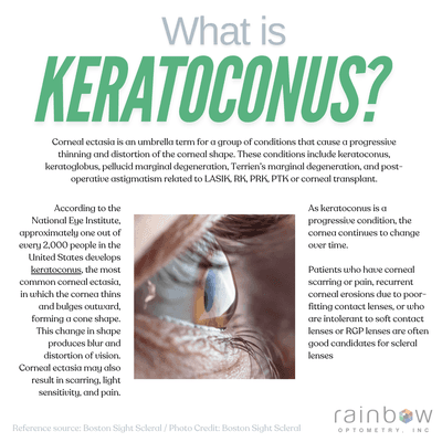 Learn about Keratoconus! Our doctor specializes in specialty contact lenses. Reach out so we can help you see better.