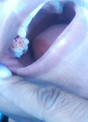 THE MONSTER DR. TAIWO OGUNDIPE PULLED THE WRONG TOOTH