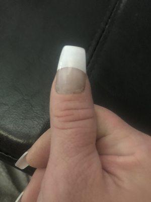 Crooked nail, not finger