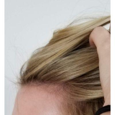 Hairline detail of my blonde highlight. It looks so natural I love it!