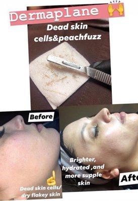 Dermaplane Facials $55