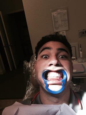 Fun times at the Dentist!! I always wondered what I looked like while they did dentist things to me...