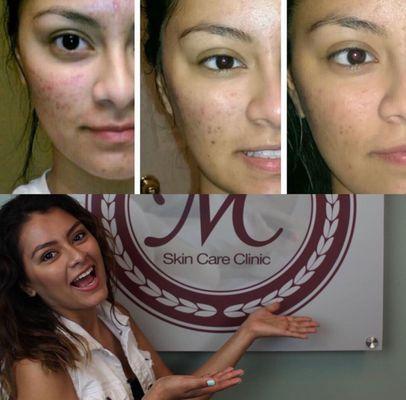 Real Customers - Real Results using Morris Code Beauty® Advanced Aesthetics Skin Care Products & Services!