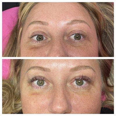 Lash lift