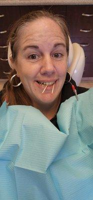 Getting ready for my root canal!!! Easy peasy