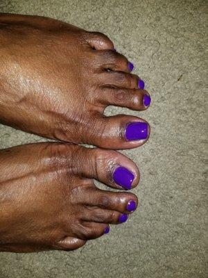 Awesome toes