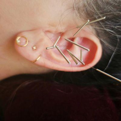 Some ear acupuncture for fatigue, insomnia, and auto immune support.