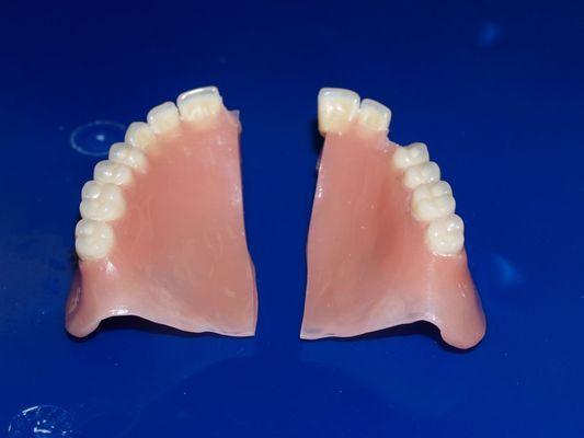 Not only making dentures, we also fix fully broken like this, and it cracks, chips and much more, contact us!