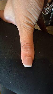 thumb super crooked