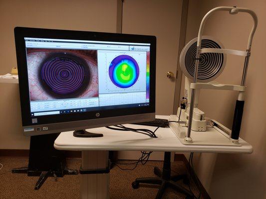 Corneal mapping & Dry eye evaluations with the 5M