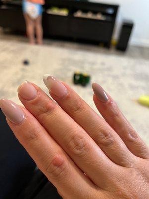 Infection from nail salon