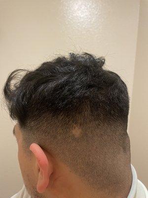 Bald spot from barber. Didn't even let me know about it. Was pretty aggressive during cut