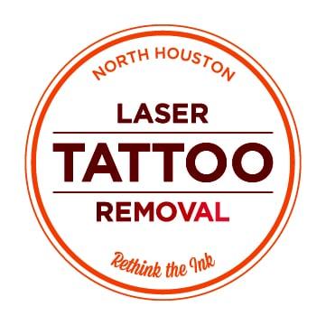 North Houston Laser Tattoo Removal