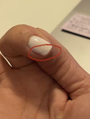 Cracked nail index finger only 2 days after service