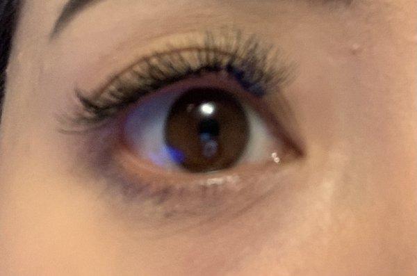 Crooked and uneven eyelashes