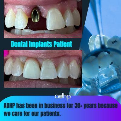 Patient had a dental implant procedure done by ADHP.