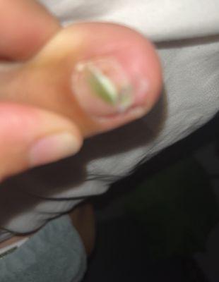 Green toe nail after I chipped white gel pedi