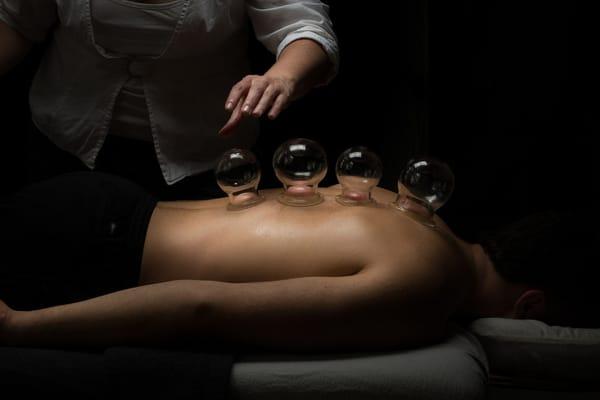 Cupping