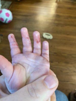 Child had been bitten at SeaQuest ,leaving bloody scrapes across three of her fingers.