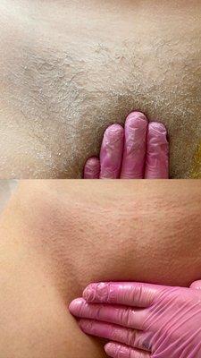 Brazilian Wax