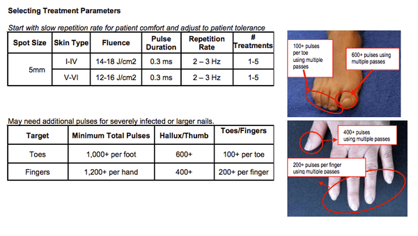 This is directly from Cutera laser treatment guidelines. He never applied any of these techniques when I paid him for such services.