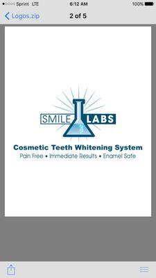 Featuring Smile Lab Professional Teeth Whitening