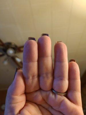 Uneven pointer finger nail