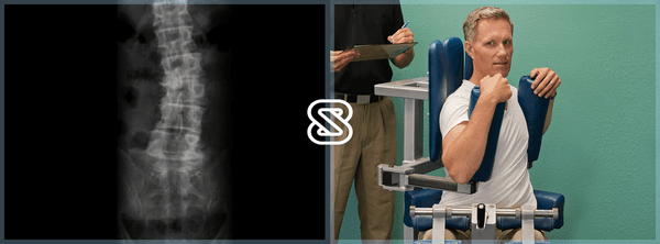 Our use of a combination of isolated strength conditioning, exercises, posture and stretching can help you manage your Scoliosis