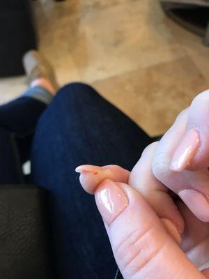 Made me bleed while filing my nail