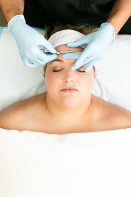 Exfoliate the skin and remove peach fuzz with dermaplaning