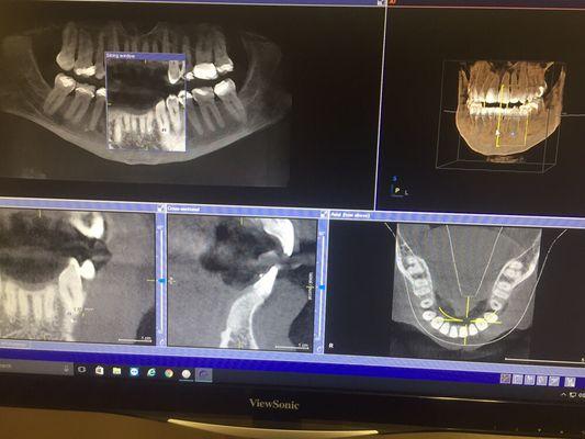 Image from Sirona XG 3D