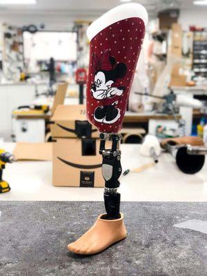 Pediatric Above-Knee Prosthetics getting some tune ups!