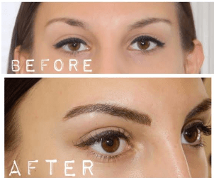 Microblading