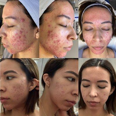 Customized skin care program