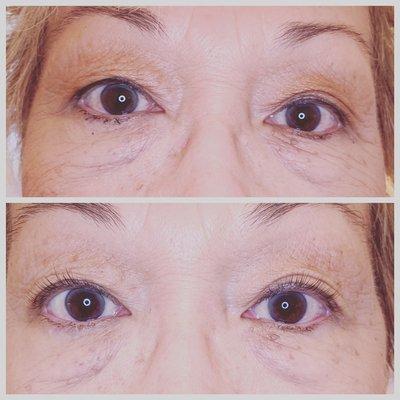 Lash lift