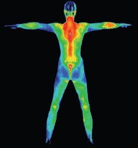 Thermography Screening