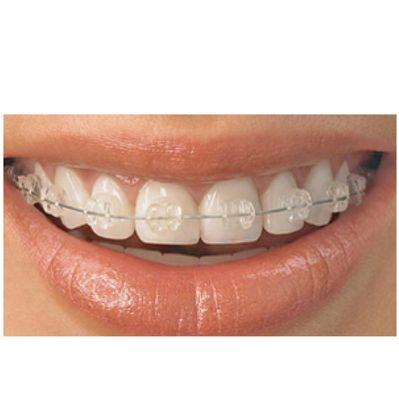 Affordable Braces. Great Smiles