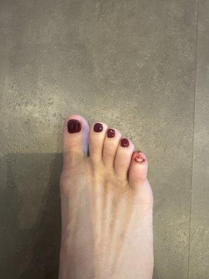 Toe nail fell off 4 hours after a pedicure