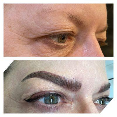 Microblading: