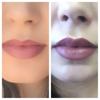 My before and after of my lips. She's incredible.