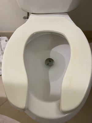 Gross toilet with no cover and stains inside