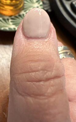 left thumb