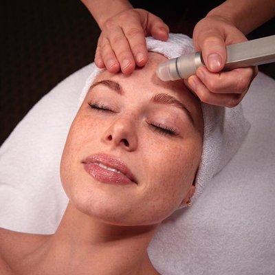 Microdermabrasion.