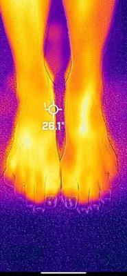 Thermal scan day 1.