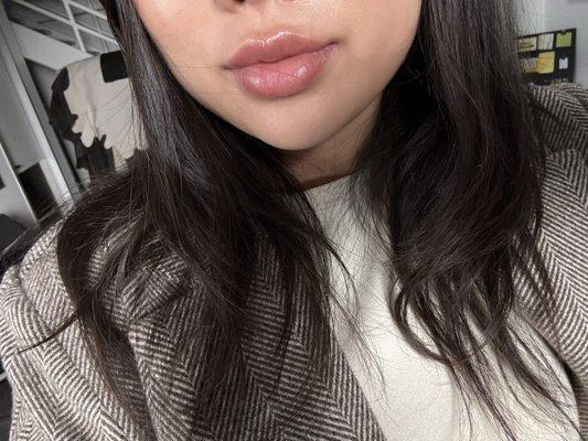 Love my new lips! Shout out to Jay, he's professional, and knowledgeable! Also great aesthetics