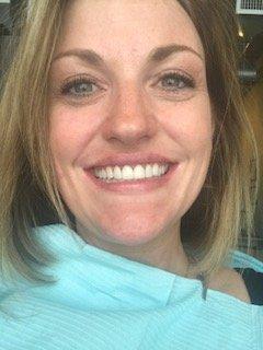 New Veneers! LOVE!