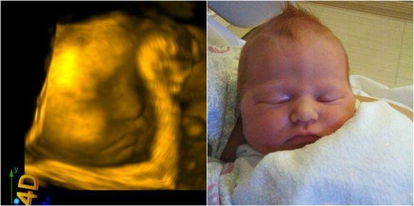 Before and after. This is little Aubrey! My newest grand daughter!